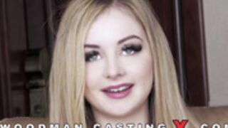 Woodman Casting X Baby Kxtten