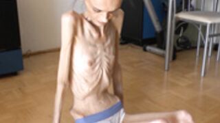 anorexic Denisa 8t00677